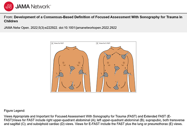 Screenshot of research depicting FAST for trauma in children