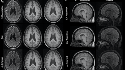 Brain MRI Scan