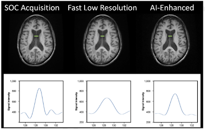 Brain MRI Scan