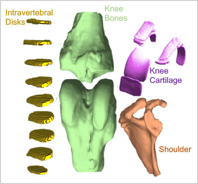 3D modeling from MRI images of different anatomies