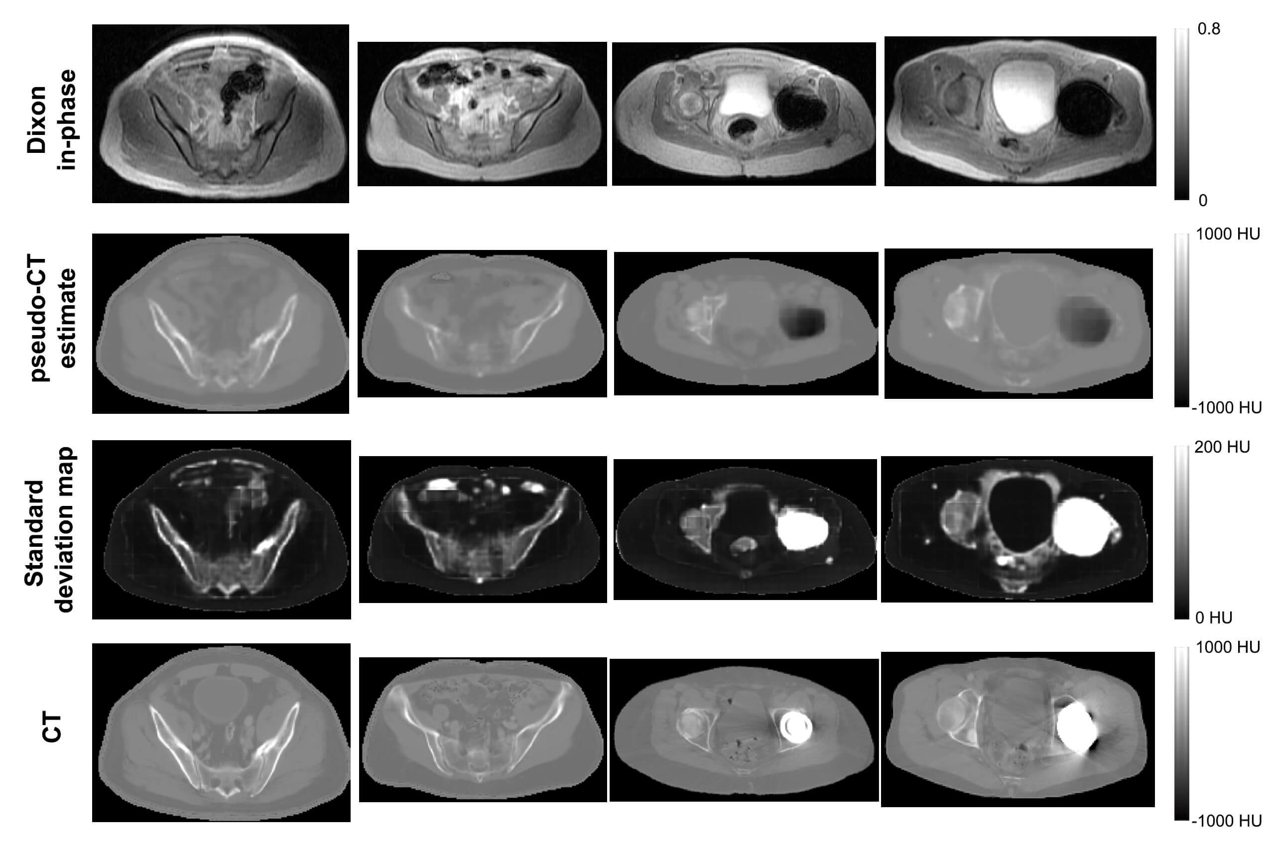 Bayesian Deep Learning for more Accurate and Robust PET.MRI Scanning