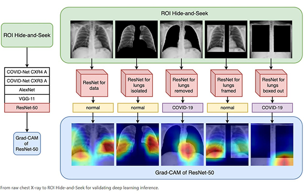  raw chest X-ray to ROI Hide-and-Seek for validating deep learning inference