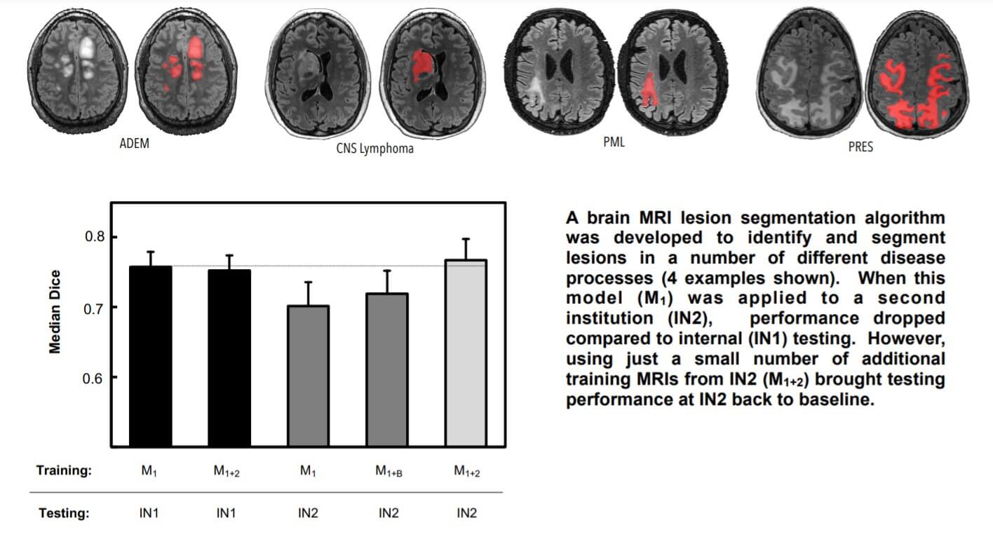 Interinstitutional Portability of a Deep Learning Brain MRI Lesion Segmentation Algorithm