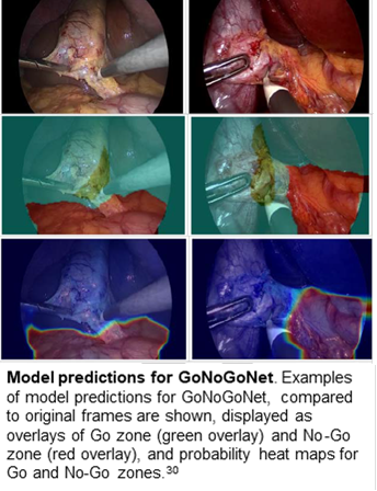 Model Predictions for GoNoGoNet