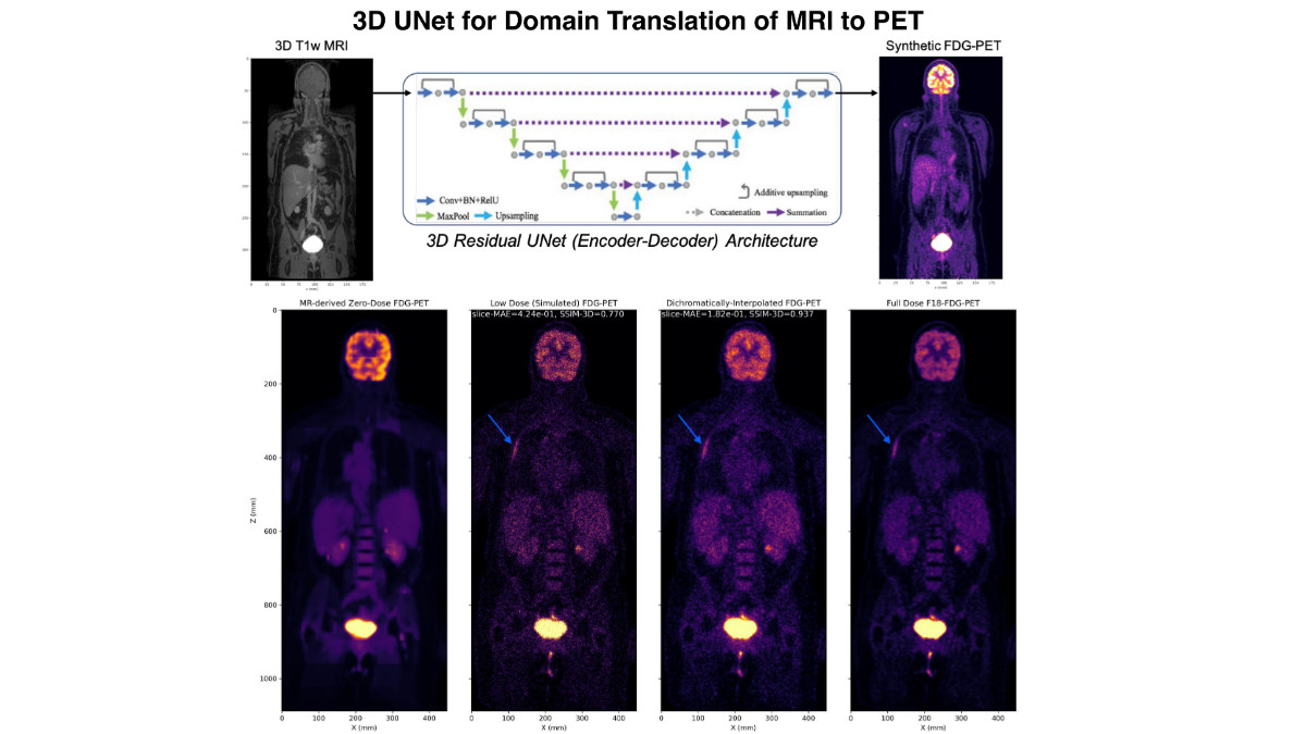 3D Unet MRI to PET