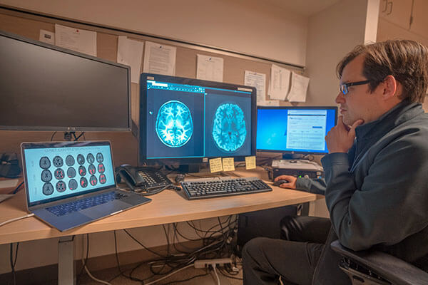 Dr. Rauschecker diagnosing brain diseases that combines AI methods.