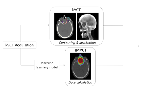 Proposed clinical workflow from UCSF Ci2 - top panel shows a kVCT scan and bottom panel shows a sMVCT using machine learning 