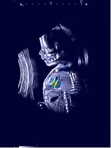 Ultrasound image