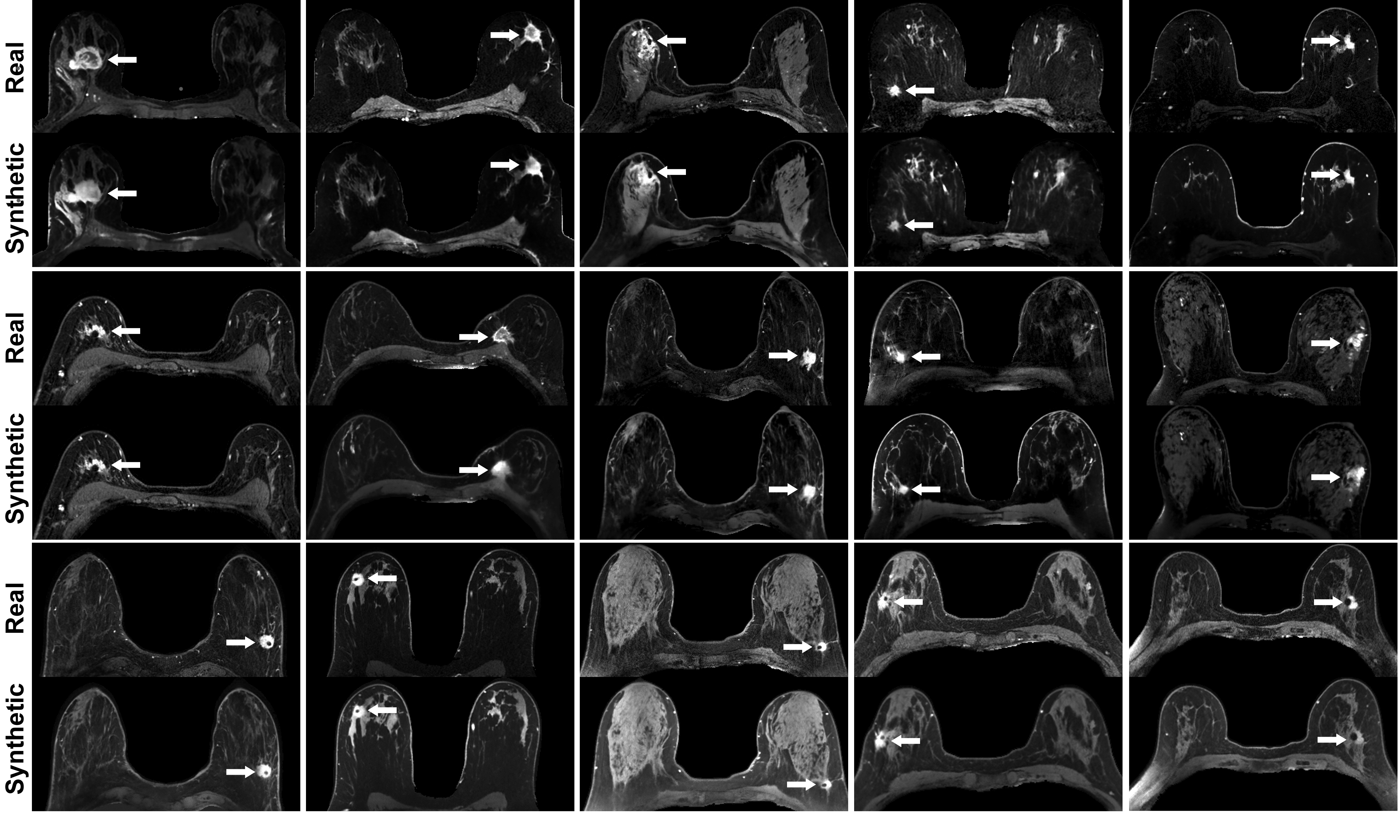 Medical image of a study demonstrating the feasibility of using deep learning to simulate contrast-enhanced breast MRI for imaging malignant masses