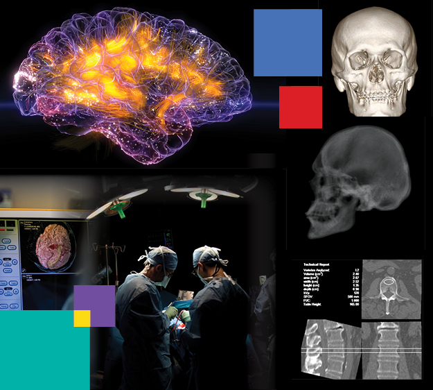 collage of 3D images, brain x-ray