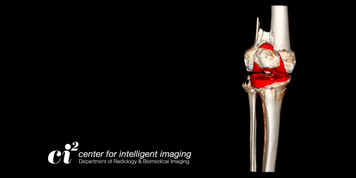 A knee visualization provided by the 3DLab at UCSF.