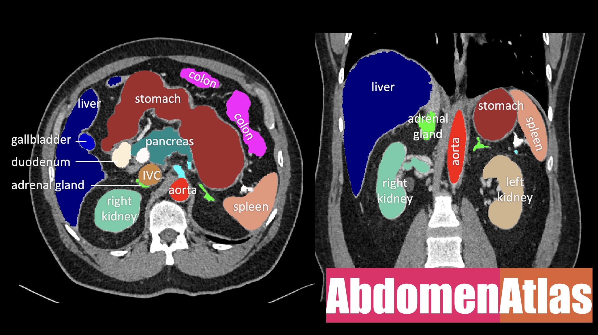 Graphical abstract of the research