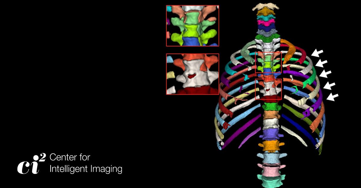 Zongwei Zhou's, PhD, Visionary Approach to Medical Imaging