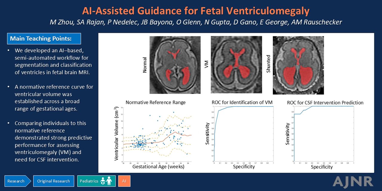 AI-Assisted Guidance for Fetal Ventriculomegaly