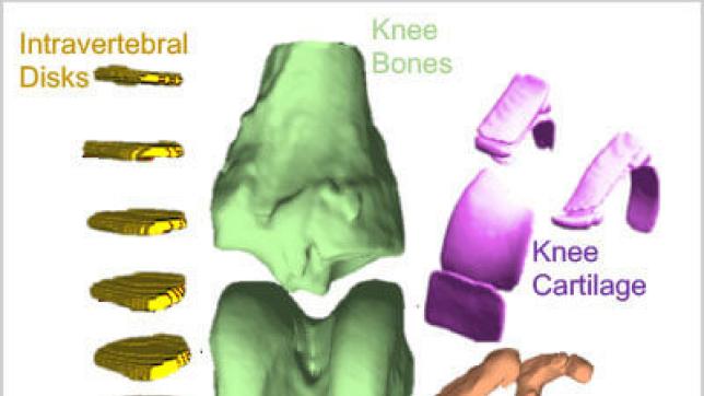 3D MRI