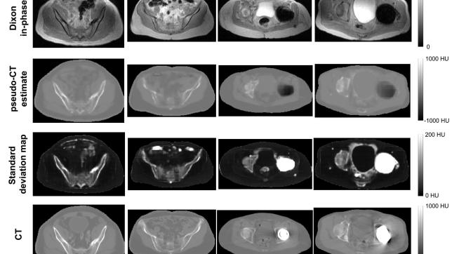 Bayesian Deep Learning for more Accurate and Robust PET.MRI Scanning