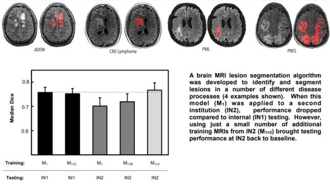 Interinstitutional Portability of a Deep Learning Brain MRI Lesion Segmentation Algorithm