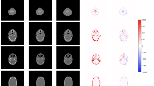 Example images from four different test subject scans of kVCT images 