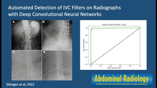 The graphical abstract of the research on automated detection of IVC filters on radiographs.