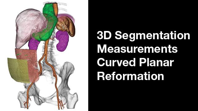 3D Segmentation Measurements Curved Planar Reformation (CPR)