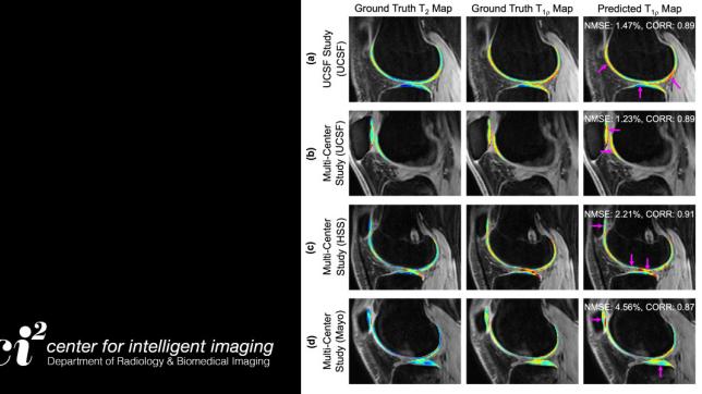 New Approach to Deep Learning Imaging Protocols