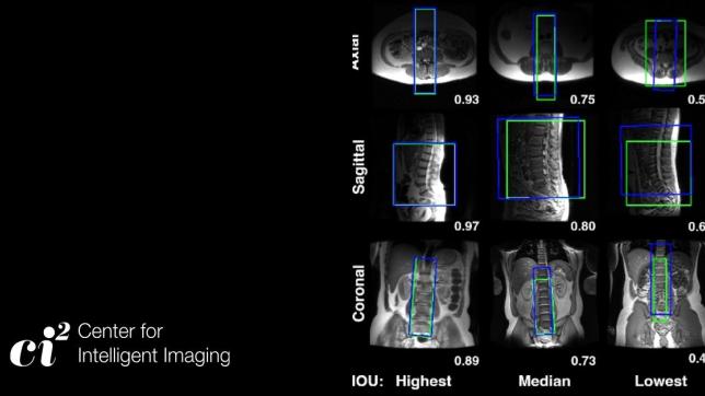 Machine Learning-based Automated MRI Scan Planning