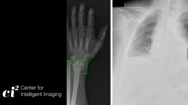 Radiological scan of a wrist and chest.