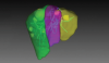 3D of liver divided in lobes